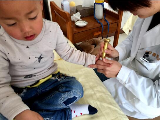小儿腺样体肥大推拿
